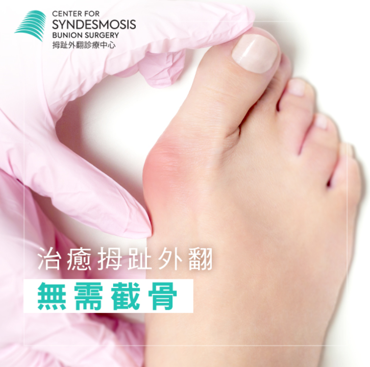 Knowledge Bunions Results in Warning signs together with Treatment plans